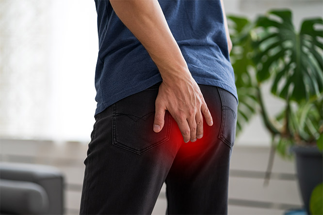 Haemorrhoid Management Guide: Causes, Treatment, Coping Strategies, Lifestyle Changes, And More