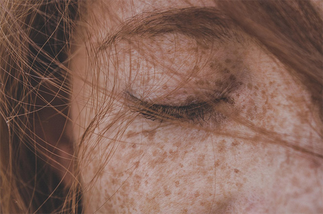 Eyelid hygiene – why you should care